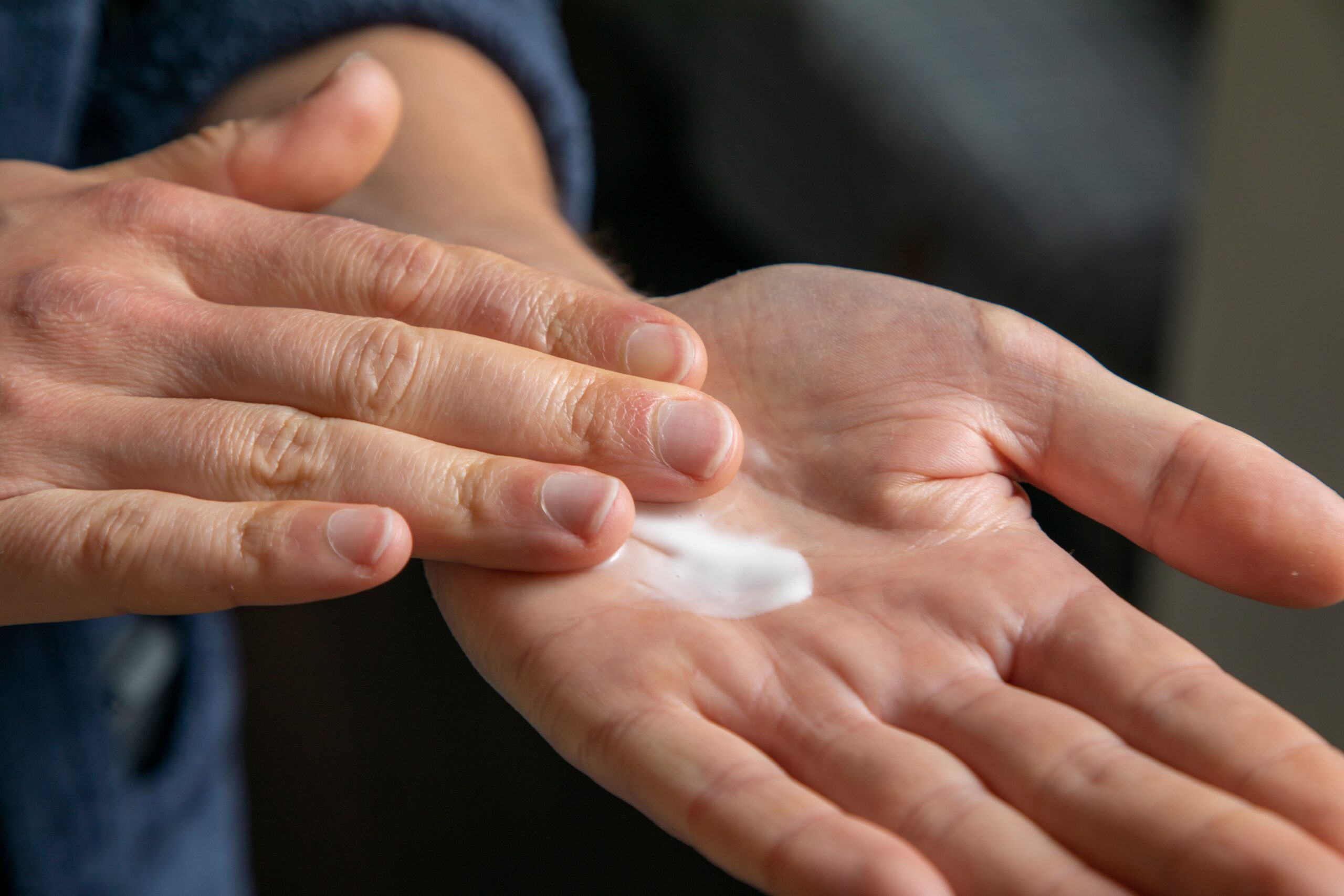 Close-up of hands with pain relief cream on the palm, the way Blue-Emu's trolamine salicylate cream is meant to be applied