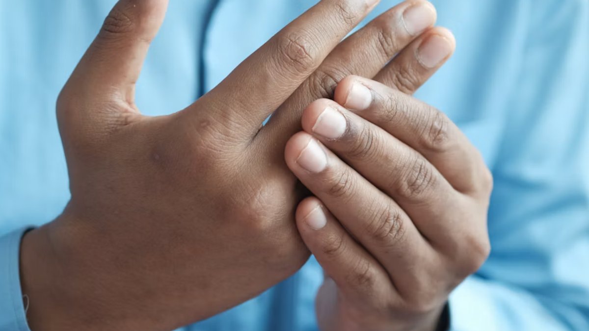 Close-up of hands showing finger and wrist joint pain, the kind of arthritis discomfort Voltaren gel is meant to treat